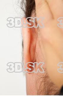 Ear texture of Drew 0003